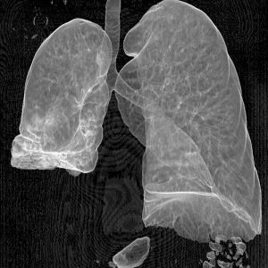 BroCa Z.n. BroCa Z.n.